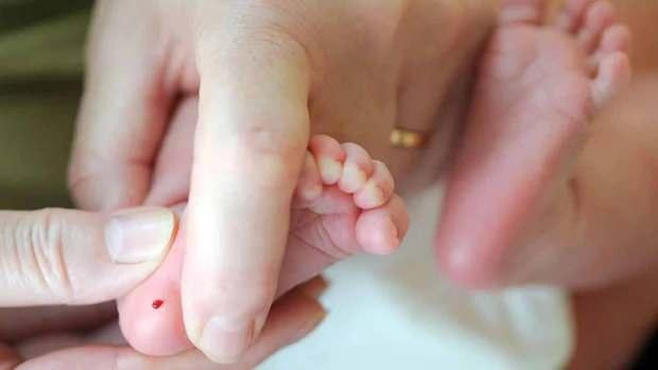 Fenilketonüri hastalığı nedir, belirtileri nelerdir?