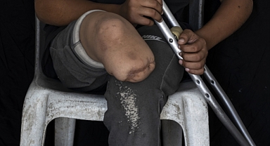 Gazze'de Binlerce Çocuk İsrail Saldırılarında Uzuvlarını Kaybetti