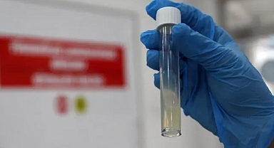 DSÖ: Tüberküloz, 2024'te 1,23 milyon kişinin ölümüne yol açtı