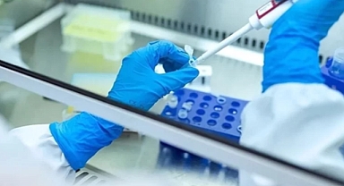 Kan testiyle kanser teşhisinde umut veren gelişme