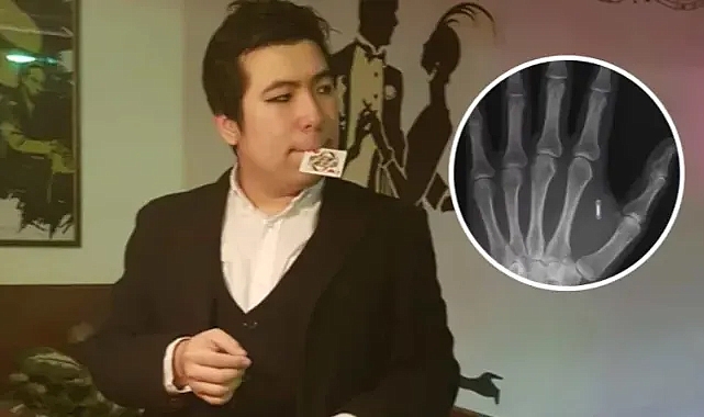 Moleküler Biyolog Wang, Elindeki RFID Çipin Şifresini Unuttu