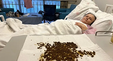 Soma'da 70 Yaşındaki Hastanın Safra Kesesinden 20 Binin Üzerinde Taş Çıkarıldı