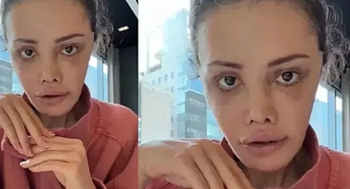 Didem Ceran Kansere Yakalandığını Açıkladı: Güney Kore’deki Yüz Nakli Sonrası Yeni Süreç