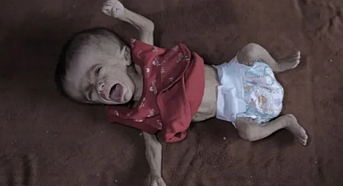 Gazze’de 5 Aylık Remzi Bahara Açlıkla Yaşam Mücadelesi Veriyor