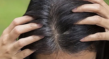  Beyaz saçları kapatan ev yapımı doğal boya tarifi