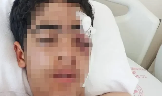 Akran Zorbalığı: 15 Yaşındaki Çocuk Muştalı Saldırıyla Ağır Yaralandı