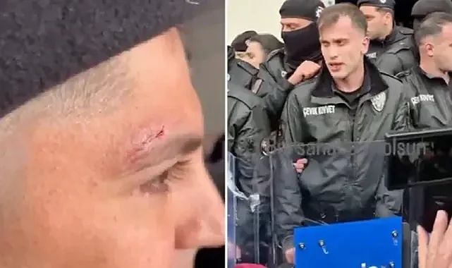 Bursa'da Başkan Vekili Seçiminde Polisler Yaralandı